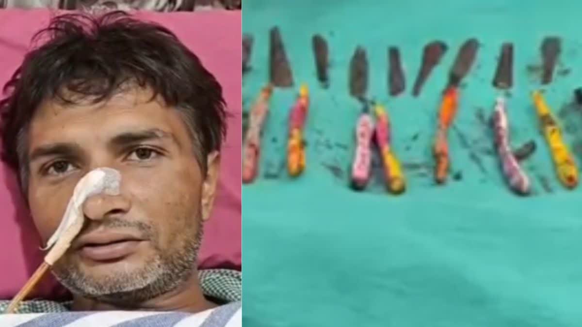 ಉತ್ತರಪ್ರದೇಶ :ಮಾದಕ ವ್ಯಸನಮುಕ್ತ ಕೇಂದ್ರಕ್ಕೆ ಸೇರಿಸಿದ ಕೋಪದಲ್ಲಿ 29 ಚಮಚ, 19 ಬ್ರಷ್‌ ನುಂಗಿದ!ಭೂಪ..!!