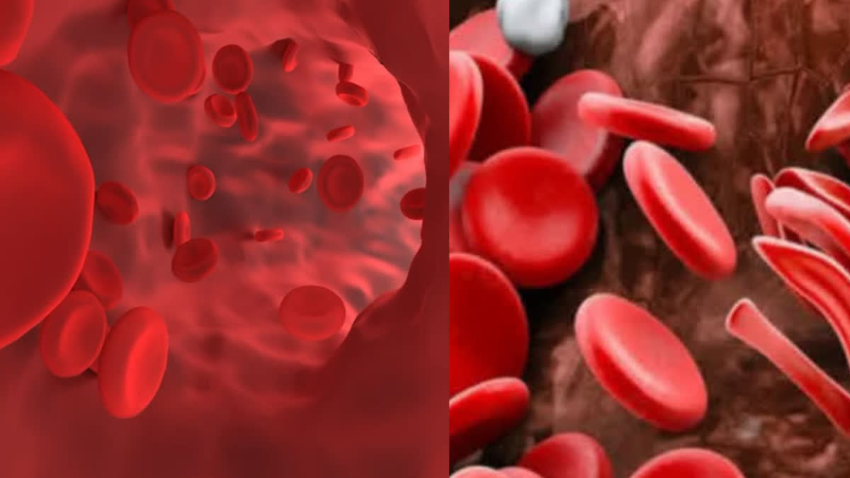 ಗ್ಲೂಕೋಸ್ 6 ಫಾಸ್ಫೇಟ್ ಡಿಹೈಡ್ರೋಜಿನೇಸ್ G6PD Deficiency Risk of anemia Glucose 6 phosphate dehydrogenase