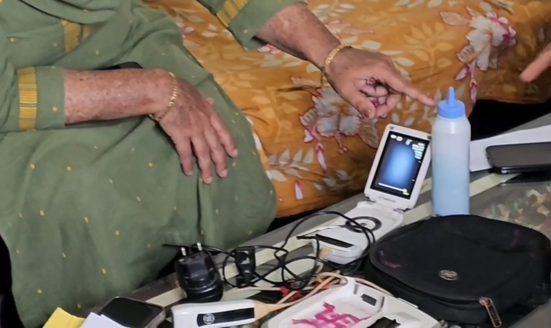 Fetal Sex Determination Case