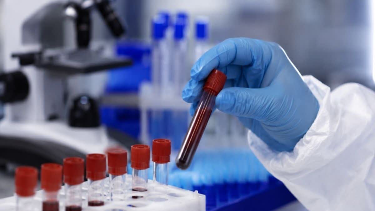Ebola Alert in Ahmedabad, 11 Passengers Under Home Quarantine