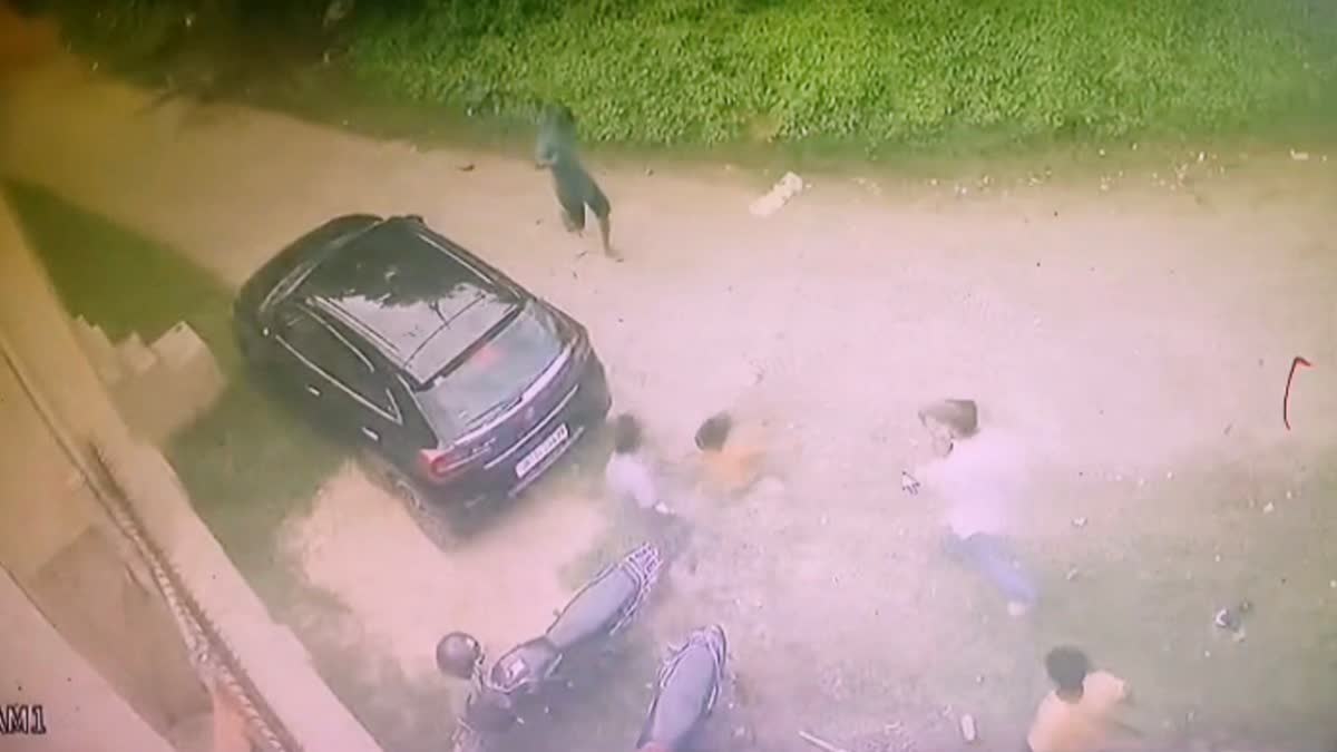 Dog bite captured on CCTV footage