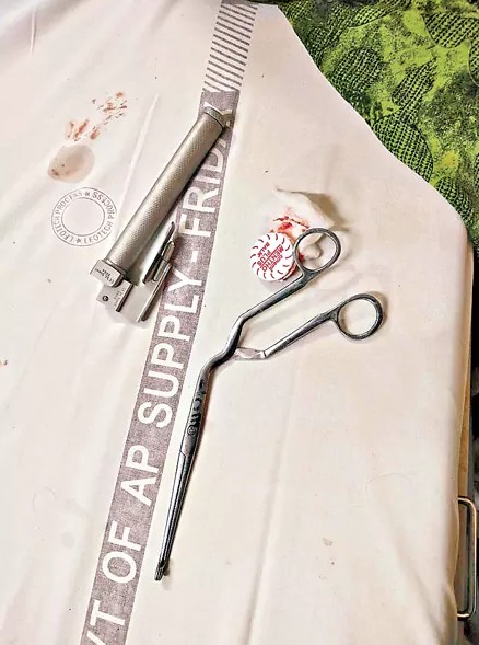 Plastic Object Stuck in Babys Throat