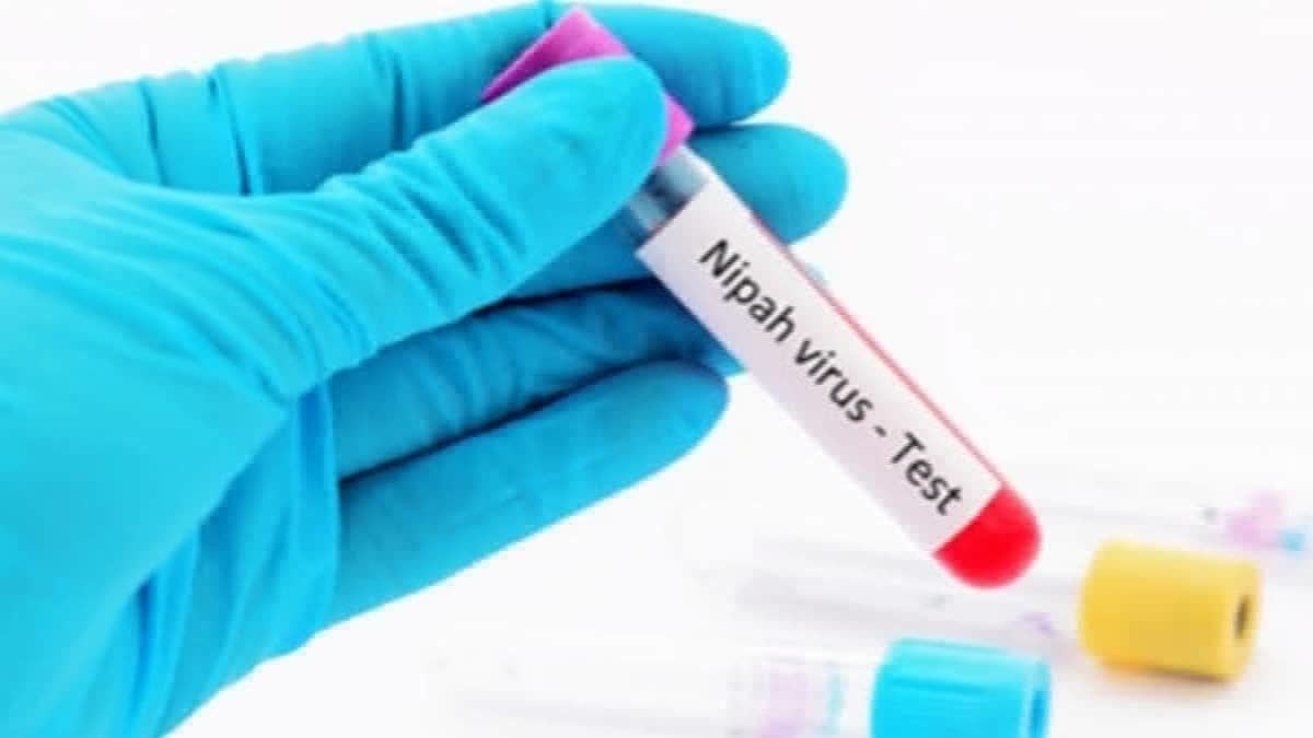 Singapore To Screen Travellers From Nipah Virus Break Areas Singapore screen travellers frorm nipah virus outbreak