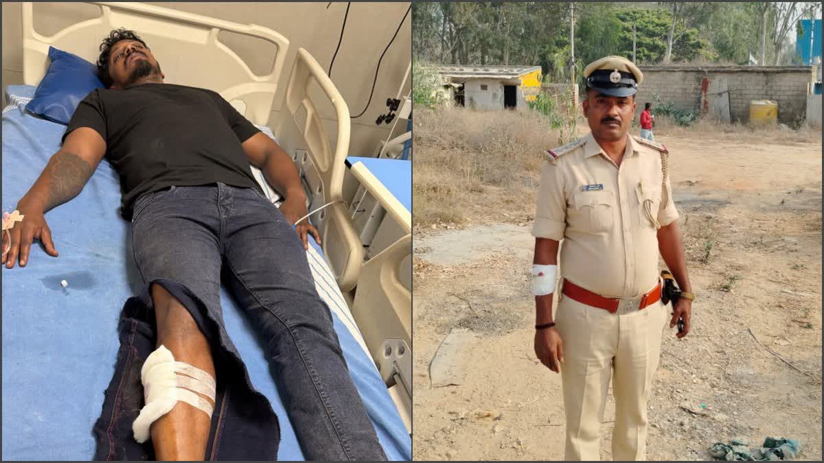 POLICE SHOOT AT ACCUSED  BENGALURU  ರೌಡಿಶೀಟರ್ ಹತ್ಯೆ  ಆರೋಪಿ ಕಾಲಿಗೆ ಪೊಲೀಸರಿಂದ ಗುಂಡೇಟು