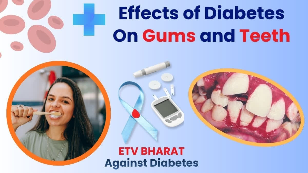 How Diabetes Impacts Your Teeth and Gums: Key Oral Health Risks