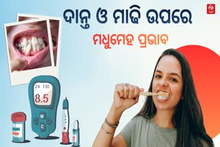 DIABETES AND ORAL HEALTH