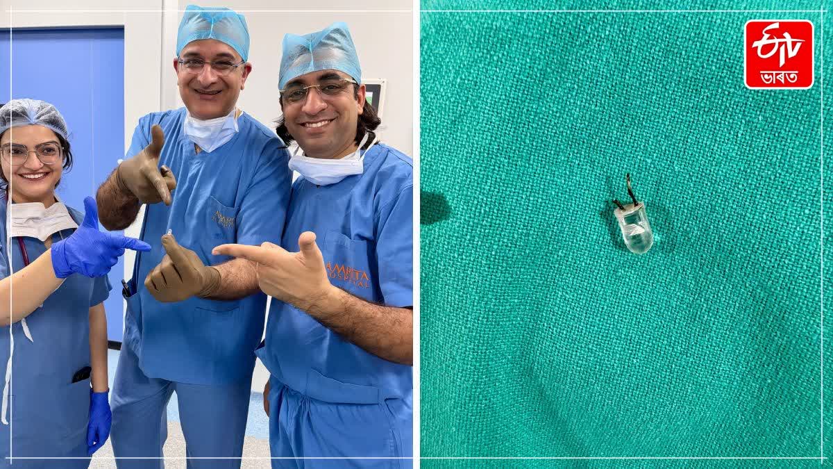 FARIDABAD REMOTE BULB STUCK IN LUNG