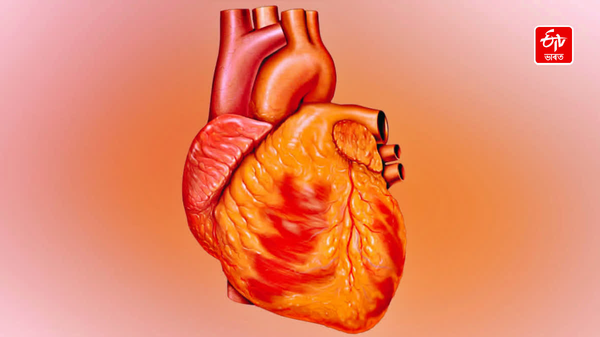 athletes heart