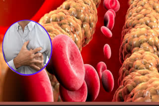 WARNING SIGNS OF HIGH CHOLESTEROL