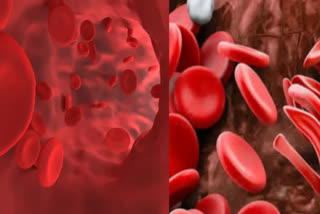 If iron deficiency in your body is not going away despite several attempts, then avoid these mistakes.