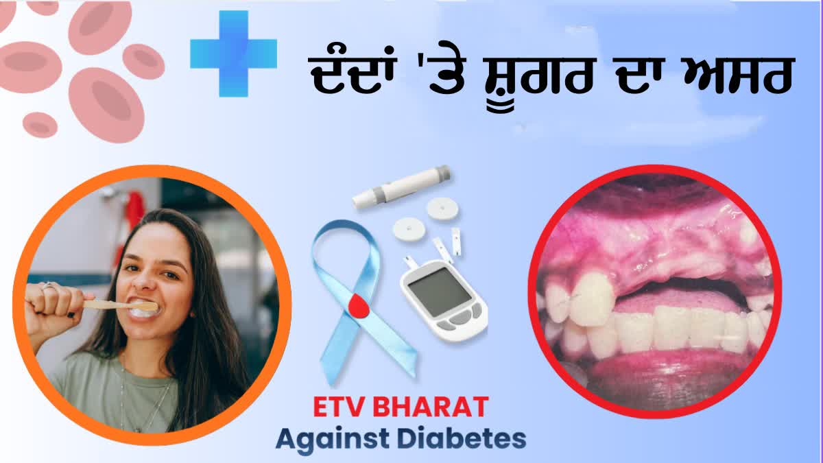 DIABETES AND ORAL HEALTH