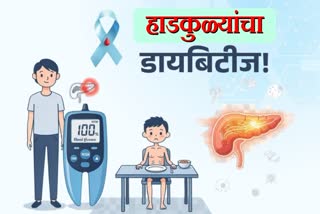 प्रातिनिधिक चित्र