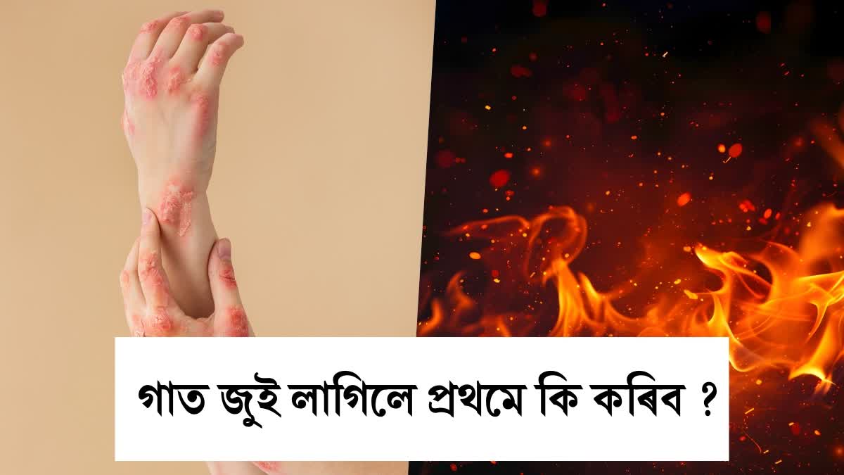 FIRE SAFETY