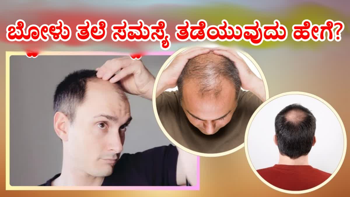 ಬೋಳು ತಲೆ ಸಮಸ್ಯೆ ತಡೆಯುವುದು ಹೇಗೆ? ಈ ಸಲಹೆಗಳನ್ನು ಅನುಸರಿಸಿದರೆ ನಿಮ್ಮ ಕೂದಲು ...