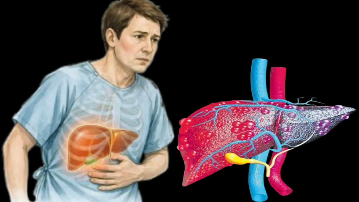 Any form of hepatitis is extremely dangerous for the liver; learn about its hidden symptoms and the precautions