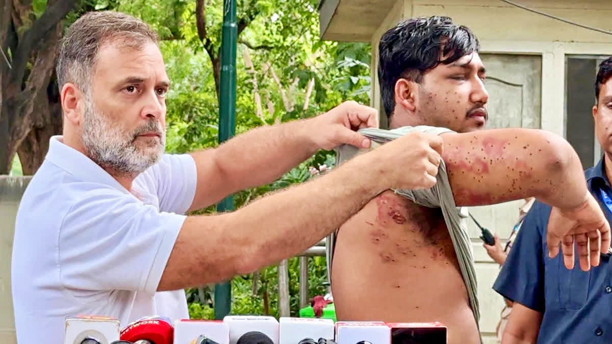 पैलेट गन विवाद के बीच जवानों के साथ खड़े हुए सीआरपीएफ महानिदेशक, बोले- 'बिना डरे करें ड्यूटी' सीआरपीएफ पैलेट गन विवाद