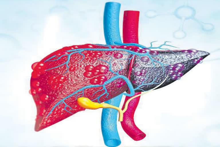 Any form of hepatitis is extremely dangerous for the liver; learn about its hidden symptoms and the precautions