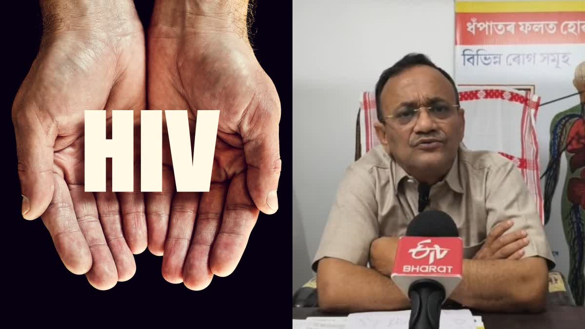 HIV PREVENTION