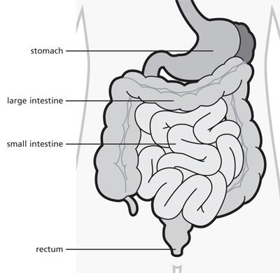 How excessive consumption of fast food can be deadly.