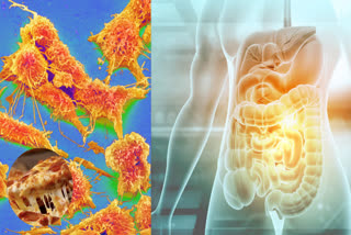 How excessive consumption of fast food can be deadly.