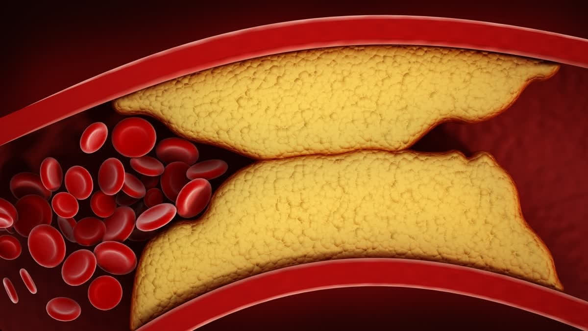 Essential Facts You Need To Know About Cholesterol And Oil Cholesterol powers the body