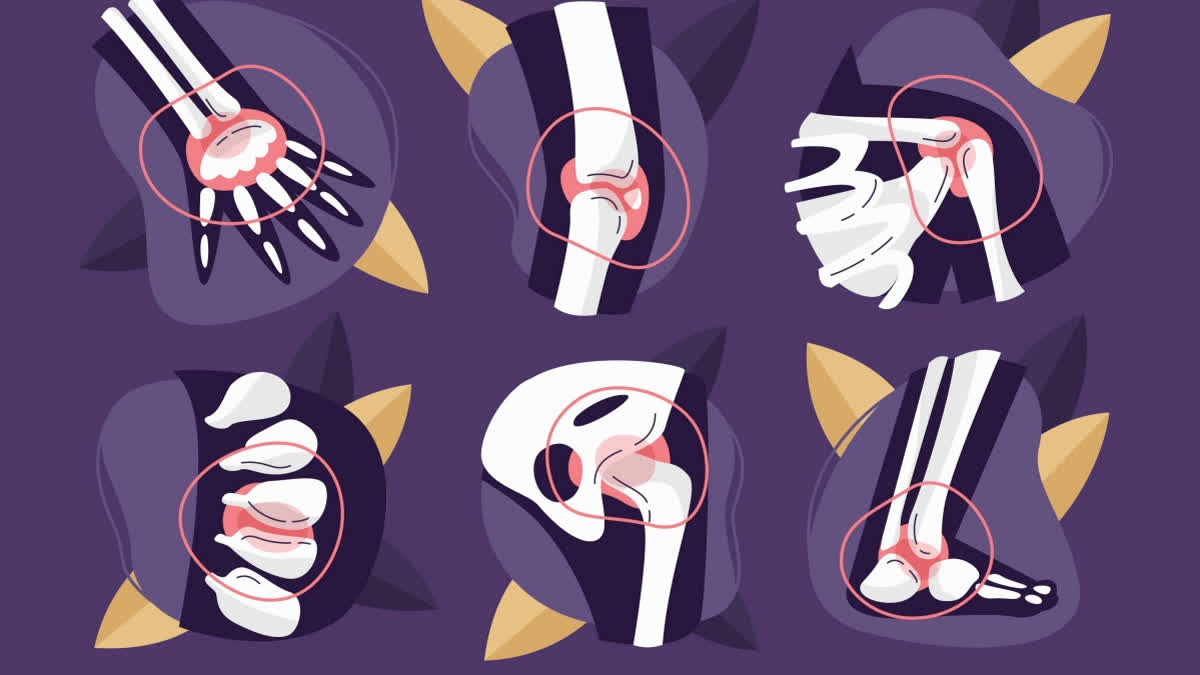 Smoking harms bone health