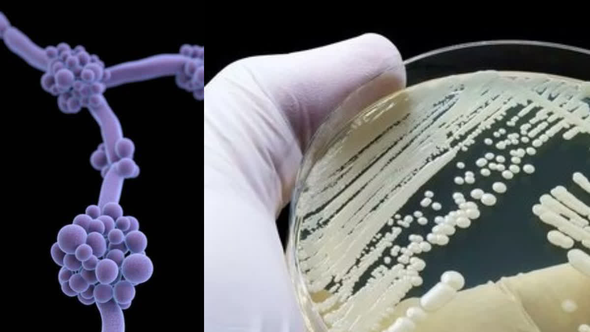 A recent study highlighted major gaps in fungal diagnostic infrastructure across Odisha's medical colleges.