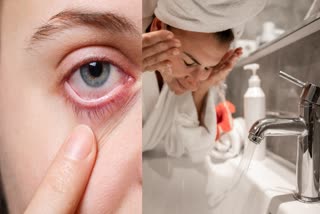 Hidden Danger in Tap Water: How Acanthamoeba Can Threaten Your Eye Health