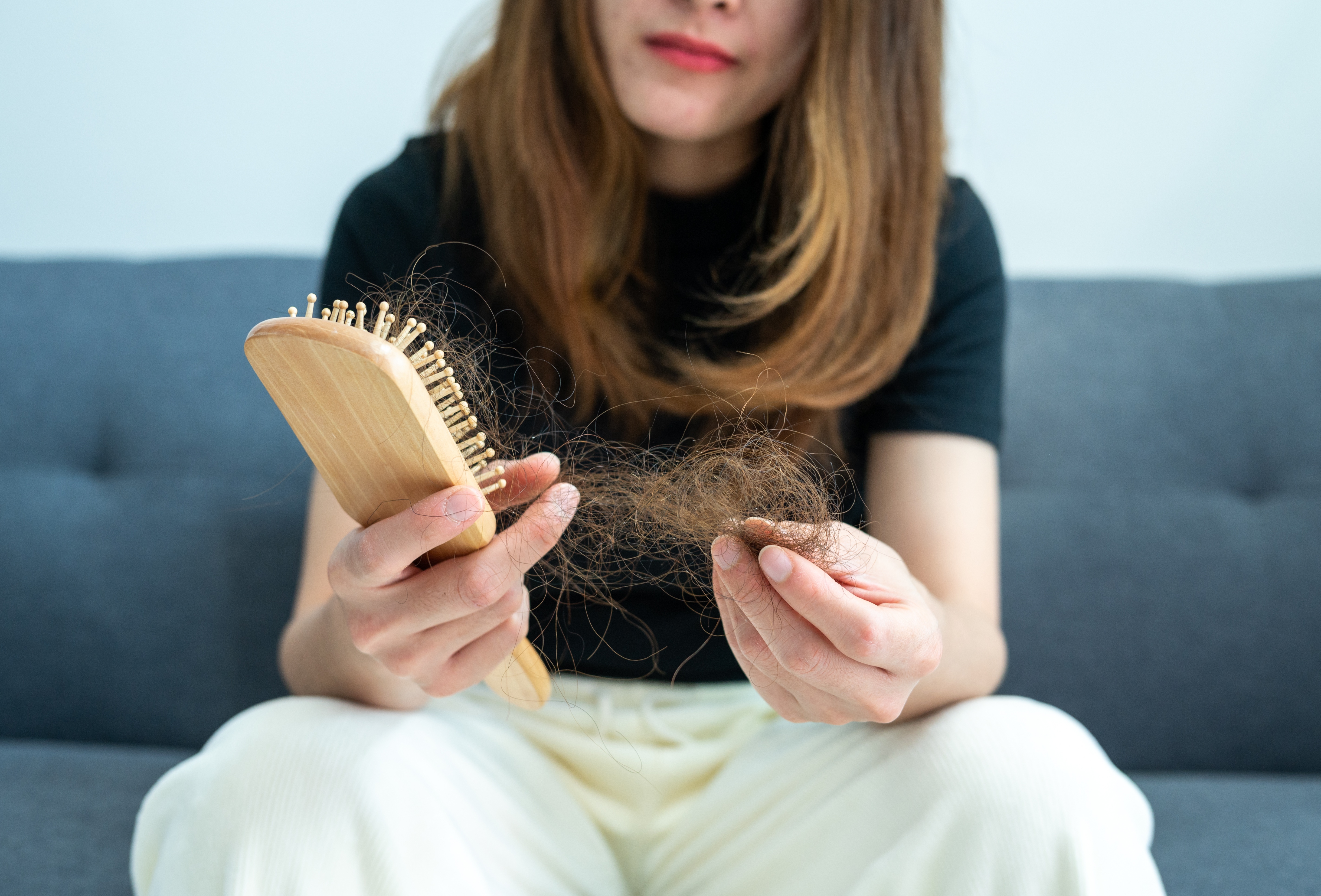 Hair Loss After Pregnancy