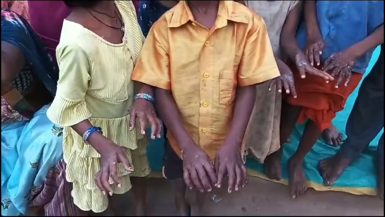 Serious Skin Disease In Korba